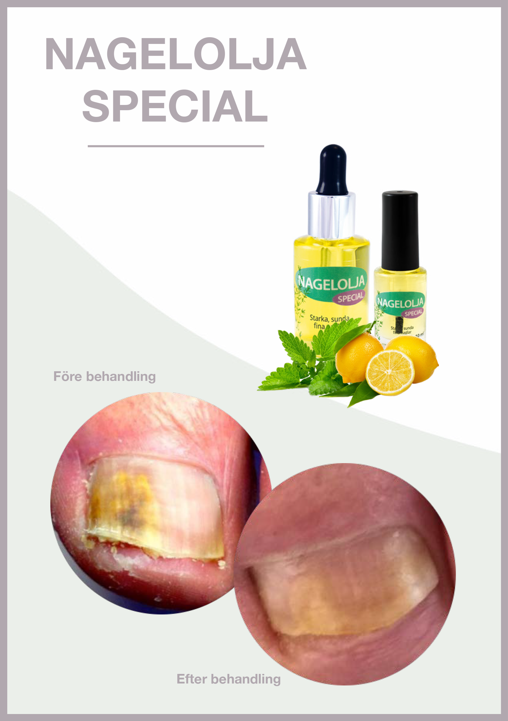Nail Oil Special - 10 ml - Kuiville ja hauraille kynsille