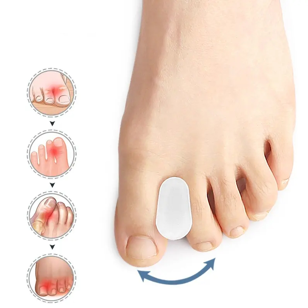 Varvaslevitin hallux valgusille - 2 palaa - Erottaa varpaat kivun vähentämiseksi - Medium (Skostorlek: 38-42)